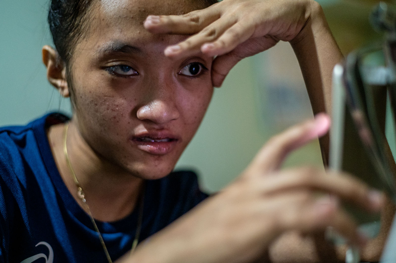 The disproportionate impact of COVID-19 pandemic among Filipinos with visual impairments